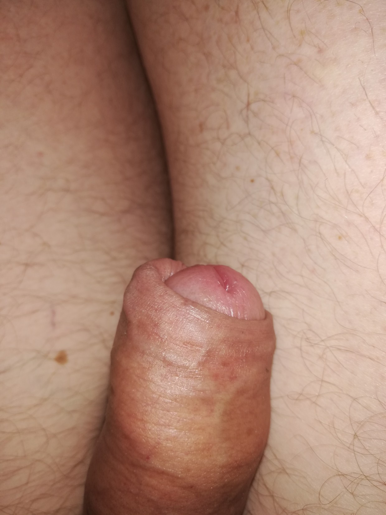 Me dick