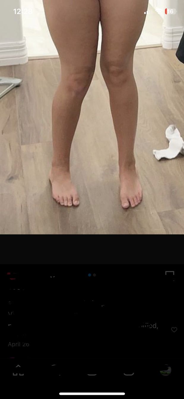 Feet