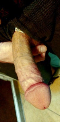 My large penis