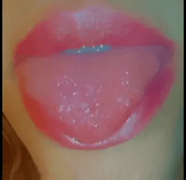 Lips