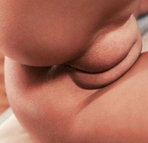 Puffy lips